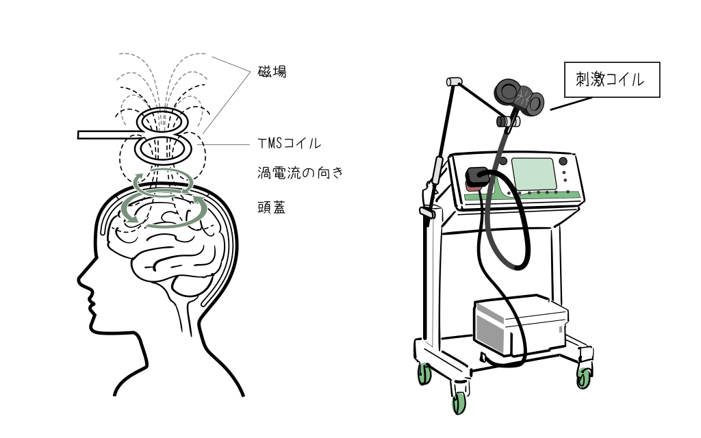 TMS治療のメカニズム