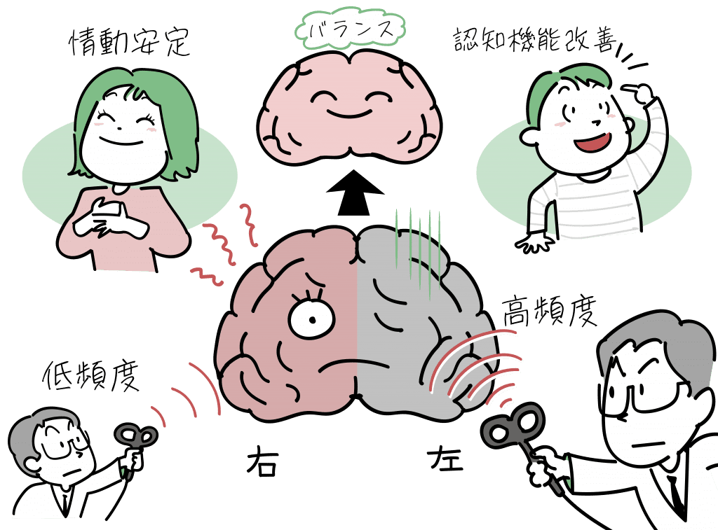 うつ病でのTMS治療の効果のメカニズムをイラストにしました。