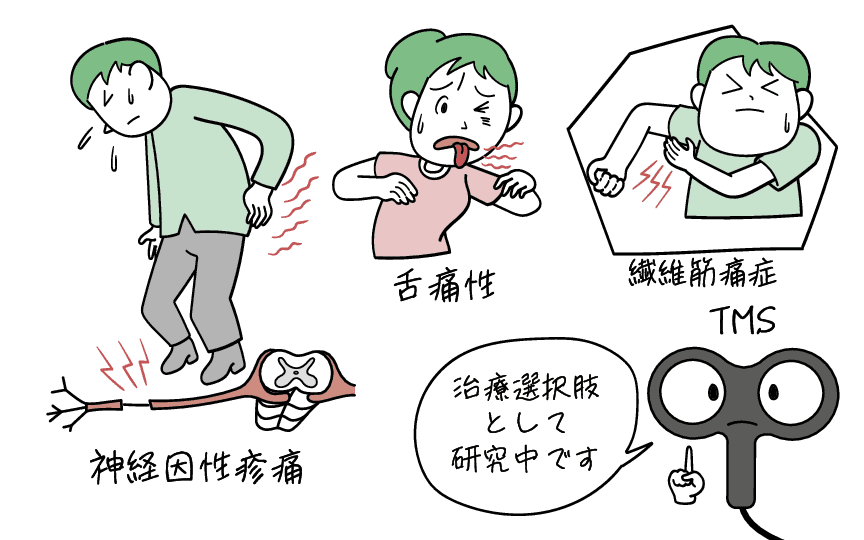 慢性痛痛でのTMS治療の効果のエビデンスをイラストにまとめました。