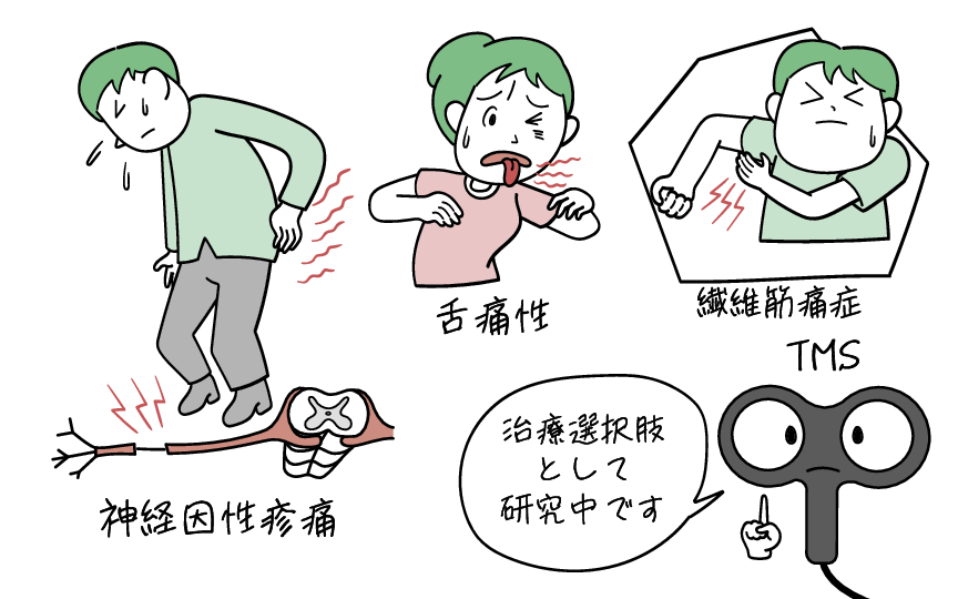 慢性と痛でのTMS治療の効果のエビデンスをイラストにまとめました。
