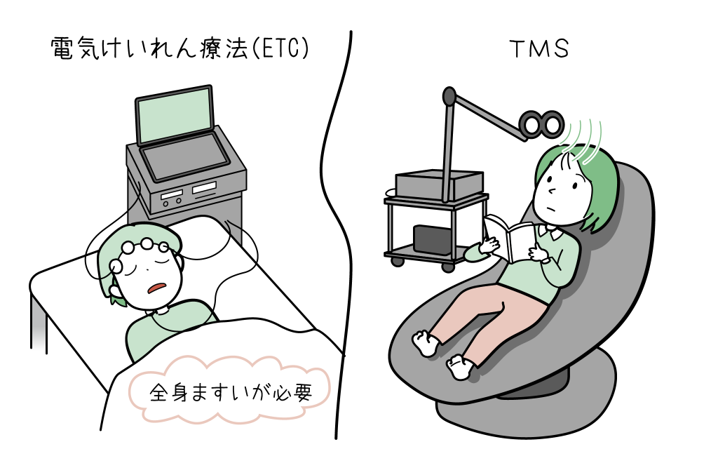 電気けいれん療法のイラストになります。